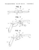 SURGICAL CUTTING GUIDE diagram and image