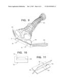 SURGICAL CUTTING GUIDE diagram and image