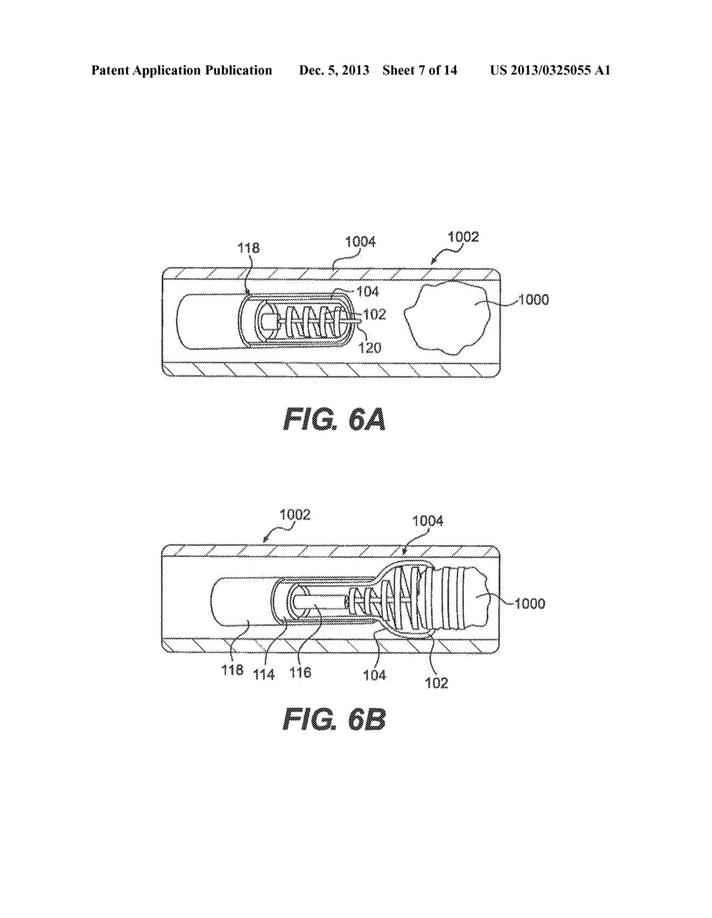 CLOT REMOVAL DEVICE WITH STEERABLE ELEMENT - diagram, schematic, and image 08