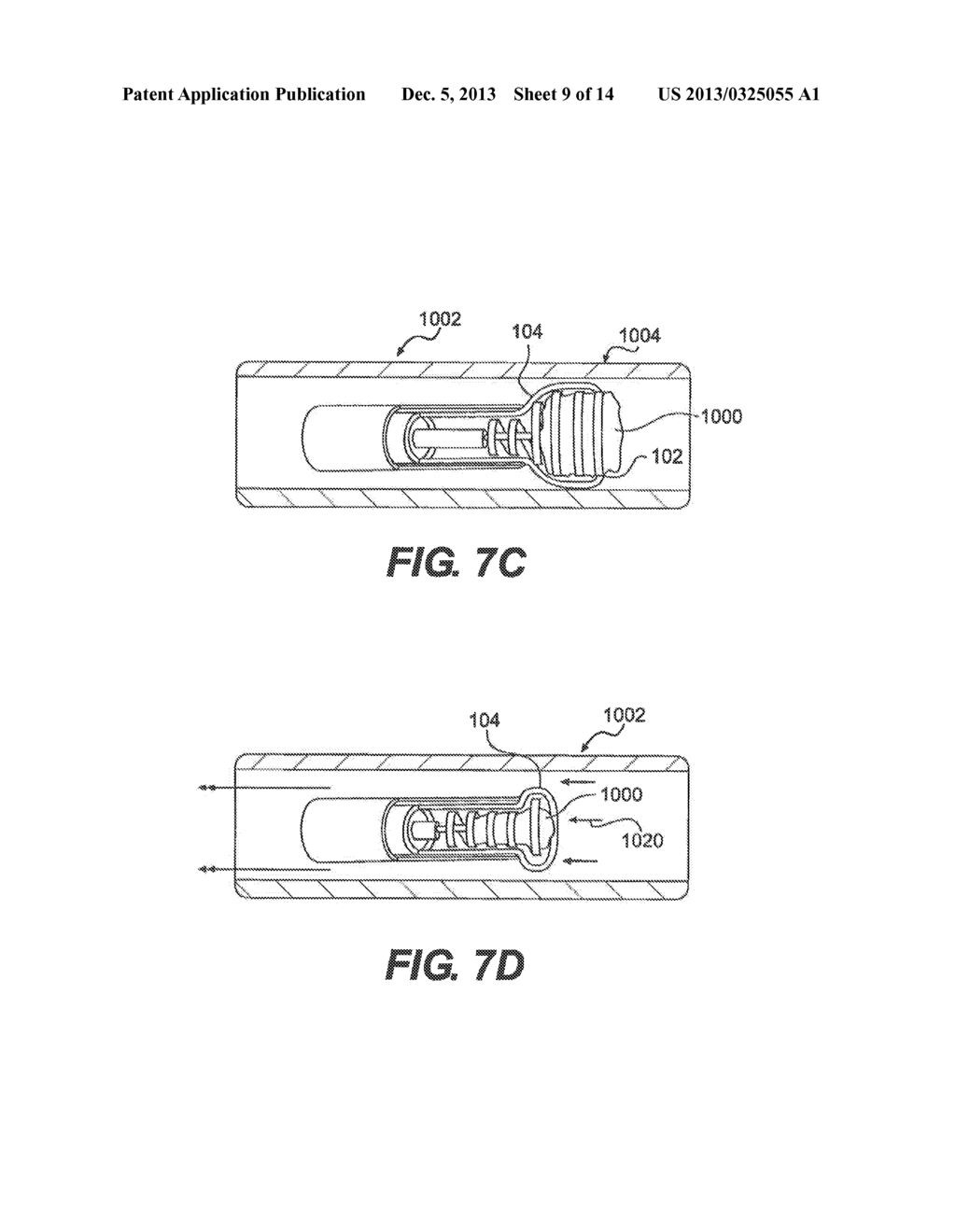 CLOT REMOVAL DEVICE WITH STEERABLE ELEMENT - diagram, schematic, and image 10