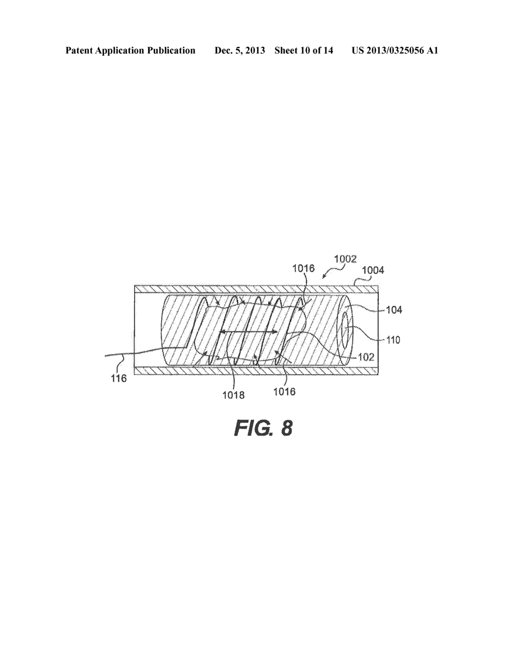 CLOT REMOVAL DEVICE WITH STEERABLE ELEMENT - diagram, schematic, and image 11