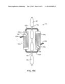 SPINOUS PROCESS CERCLAGE FOR BONE GRAFT CONTAINMENT diagram and image