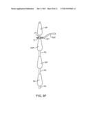 SPINOUS PROCESS CERCLAGE FOR BONE GRAFT CONTAINMENT diagram and image