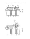 SPINOUS PROCESS CERCLAGE FOR BONE GRAFT CONTAINMENT diagram and image