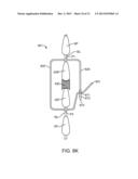 SPINOUS PROCESS CERCLAGE FOR BONE GRAFT CONTAINMENT diagram and image