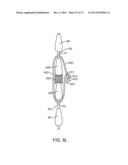 SPINOUS PROCESS CERCLAGE FOR BONE GRAFT CONTAINMENT diagram and image