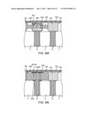 SPINOUS PROCESS CERCLAGE FOR BONE GRAFT CONTAINMENT diagram and image