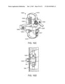 SPINOUS PROCESS CERCLAGE FOR BONE GRAFT CONTAINMENT diagram and image