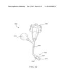 PERCUTANEOUS SPINAL IMPLANTS AND METHODS diagram and image