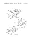 PERCUTANEOUS SPINAL IMPLANTS AND METHODS diagram and image