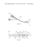 PERCUTANEOUS SPINAL IMPLANTS AND METHODS diagram and image