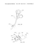 PERCUTANEOUS SPINAL IMPLANTS AND METHODS diagram and image