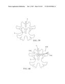 PERCUTANEOUS SPINAL IMPLANTS AND METHODS diagram and image