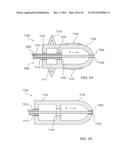 PERCUTANEOUS SPINAL IMPLANTS AND METHODS diagram and image