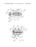 PERCUTANEOUS SPINAL IMPLANTS AND METHODS diagram and image