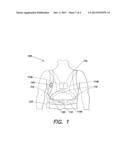 MEDICAL MONITORING AND TREATMENT DEVICE WITH EXTERNAL PACING diagram and image