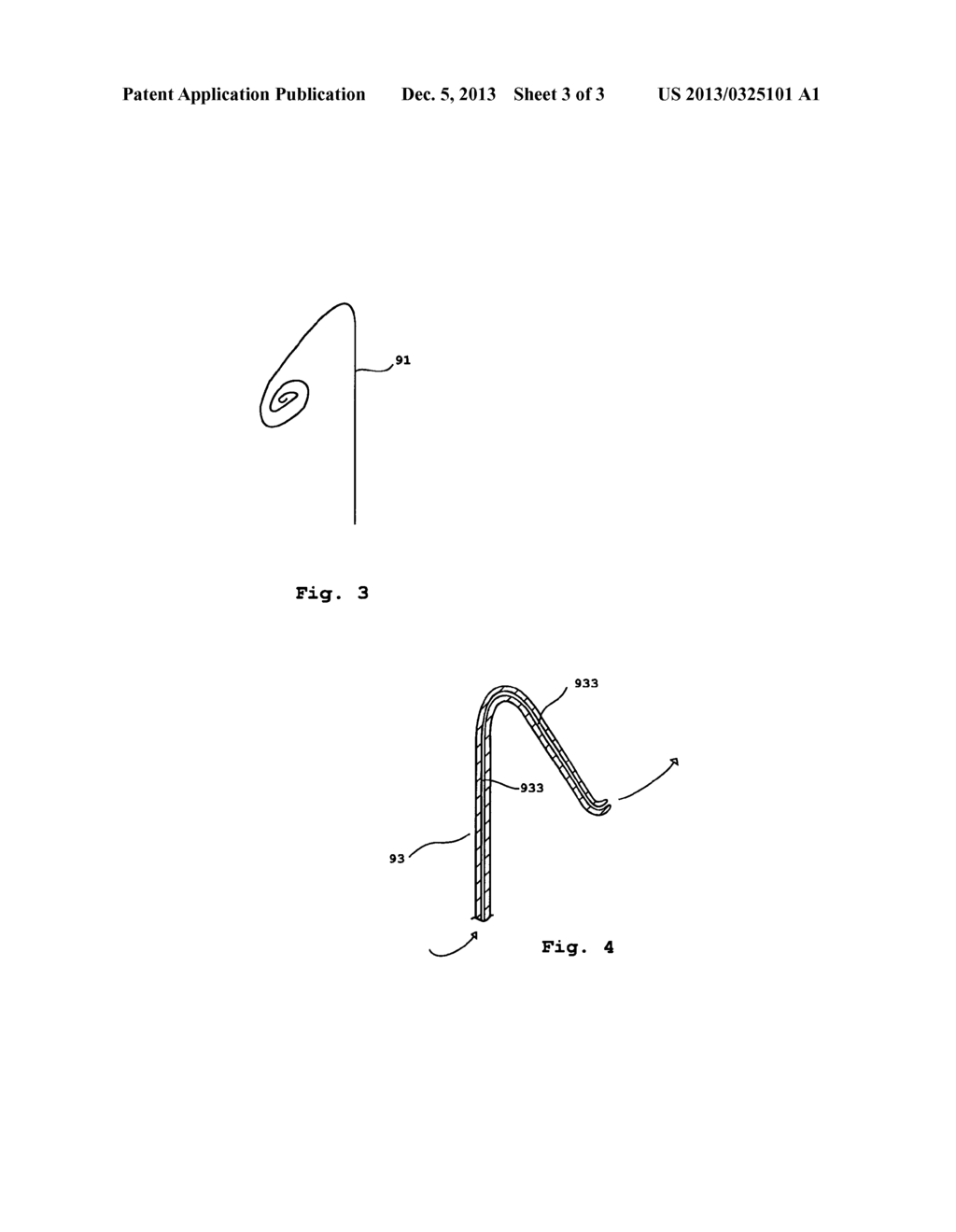 Apparatus Comprising an Aligning Device, Set and Method - diagram, schematic, and image 04