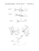PERCUTANEOUS POSITIONING DEVICE diagram and image