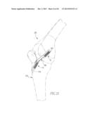 HELICOIL INTERFERENCE FIXATION SYSTEM FOR ATTACHING A GRAFT LIGAMENT TO A     BONE diagram and image