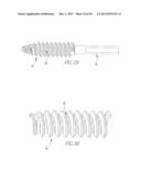 HELICOIL INTERFERENCE FIXATION SYSTEM FOR ATTACHING A GRAFT LIGAMENT TO A     BONE diagram and image