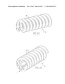 HELICOIL INTERFERENCE FIXATION SYSTEM FOR ATTACHING A GRAFT LIGAMENT TO A     BONE diagram and image