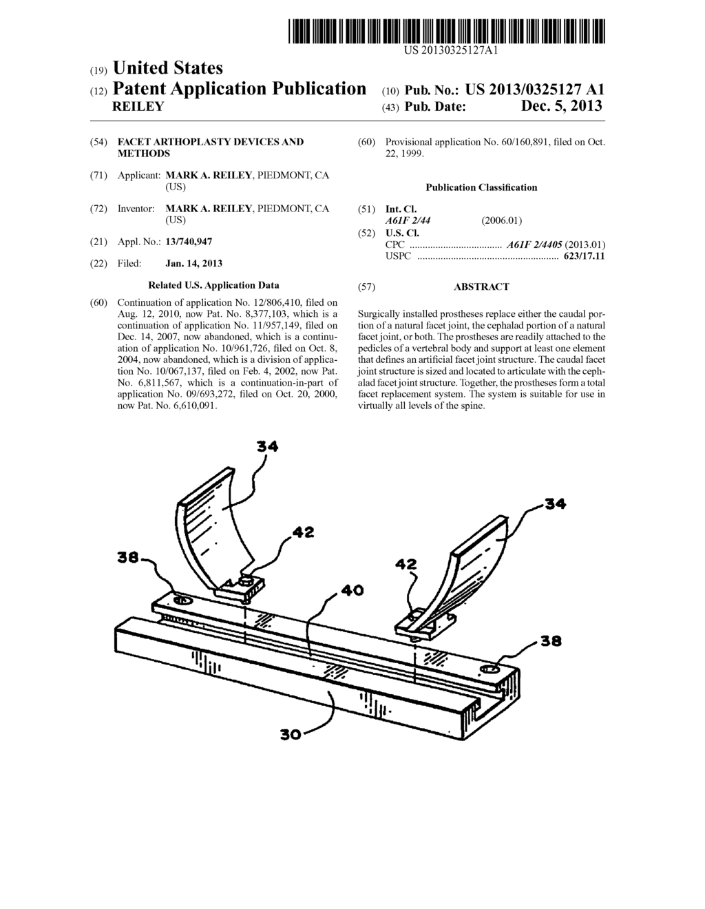 Facet Arthoplasty Devices and Methods - diagram, schematic, and image 01