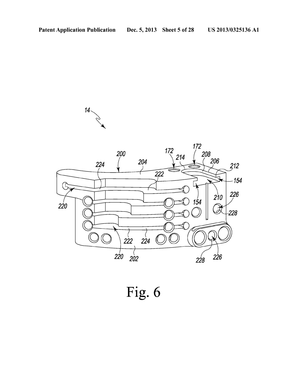 TIBIAL TRIAL INSTRUMENTS AND METHOD OF USING SAME - diagram, schematic, and image 06