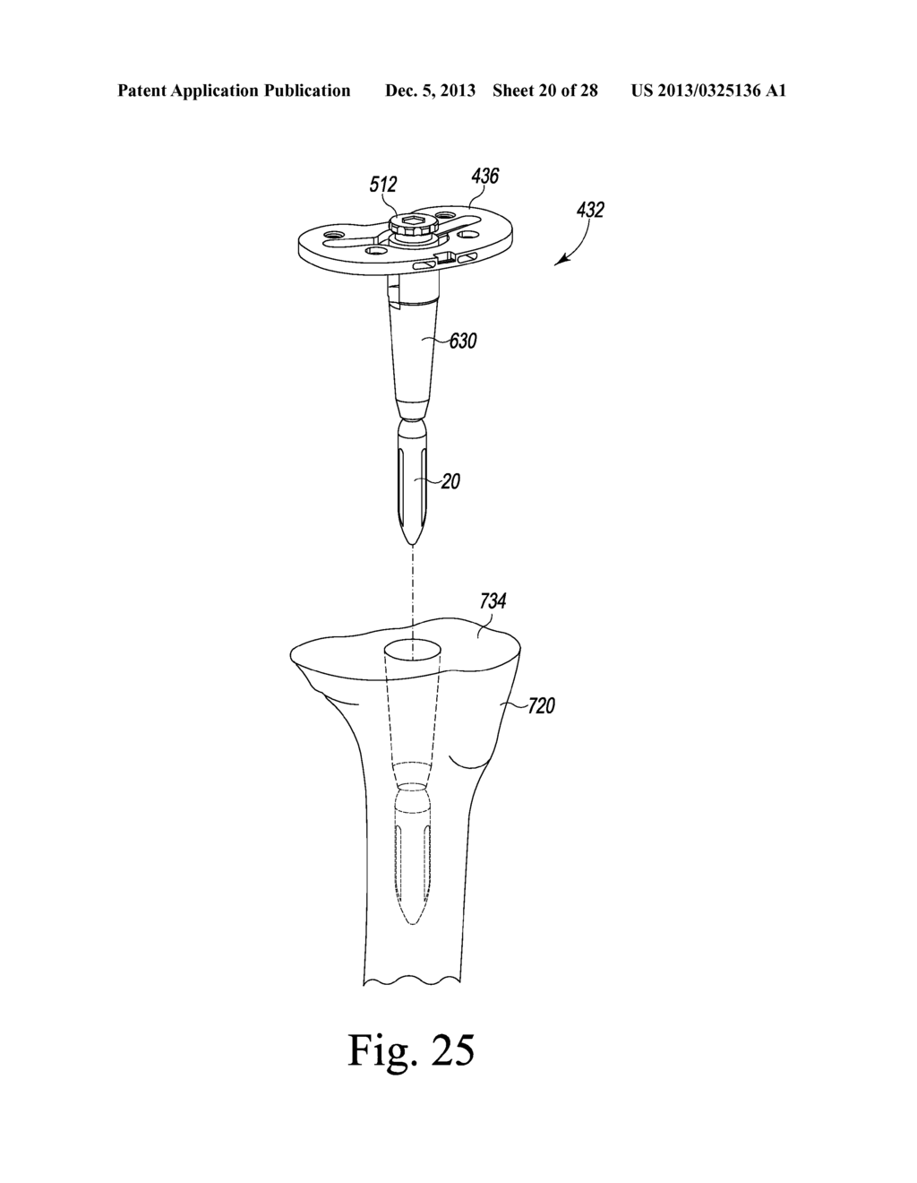 TIBIAL TRIAL INSTRUMENTS AND METHOD OF USING SAME - diagram, schematic, and image 21