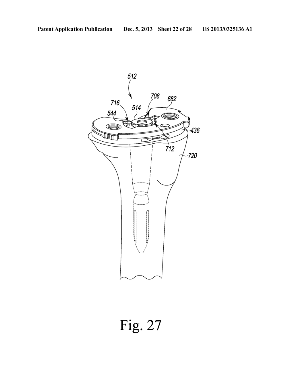 TIBIAL TRIAL INSTRUMENTS AND METHOD OF USING SAME - diagram, schematic, and image 23