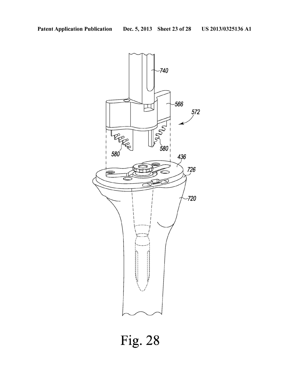 TIBIAL TRIAL INSTRUMENTS AND METHOD OF USING SAME - diagram, schematic, and image 24