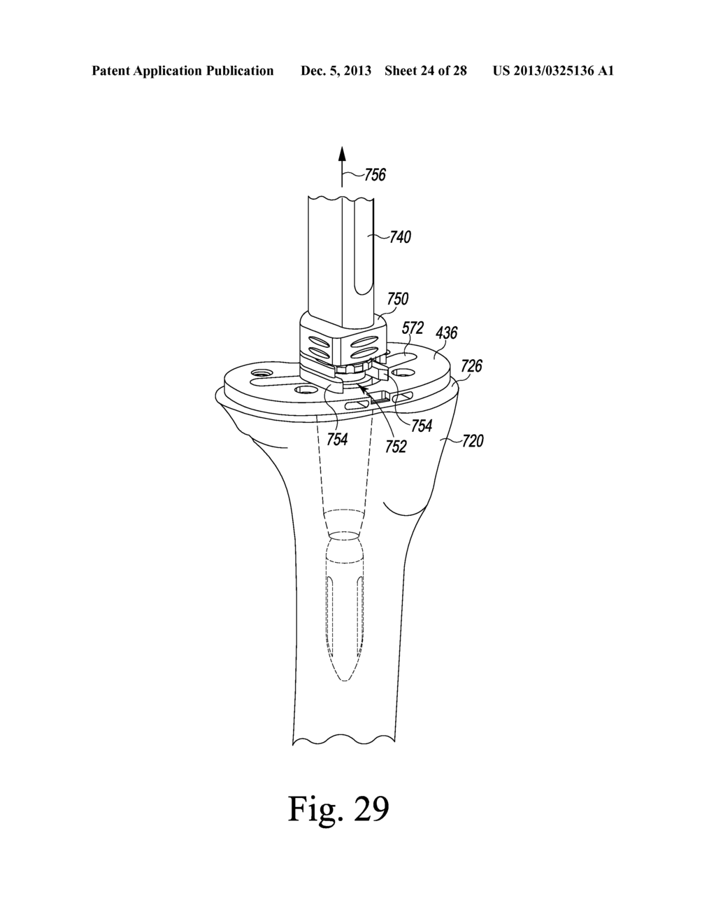 TIBIAL TRIAL INSTRUMENTS AND METHOD OF USING SAME - diagram, schematic, and image 25