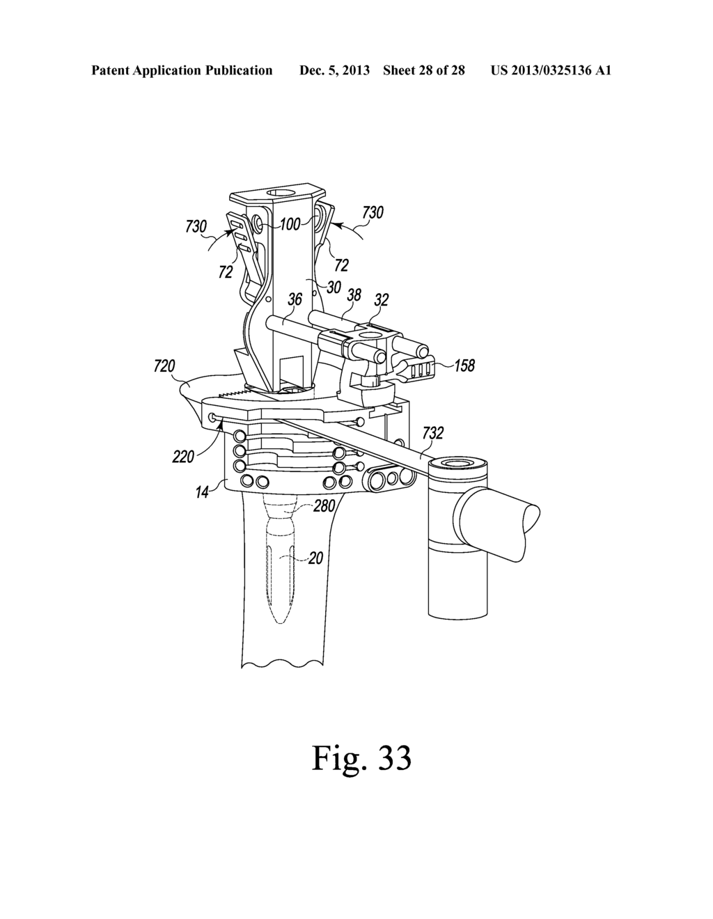 TIBIAL TRIAL INSTRUMENTS AND METHOD OF USING SAME - diagram, schematic, and image 29