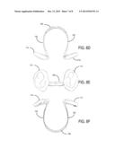 APPARATUS AND METHOD FOR WEARING REPLICA CAULIFLOWER EARS diagram and image