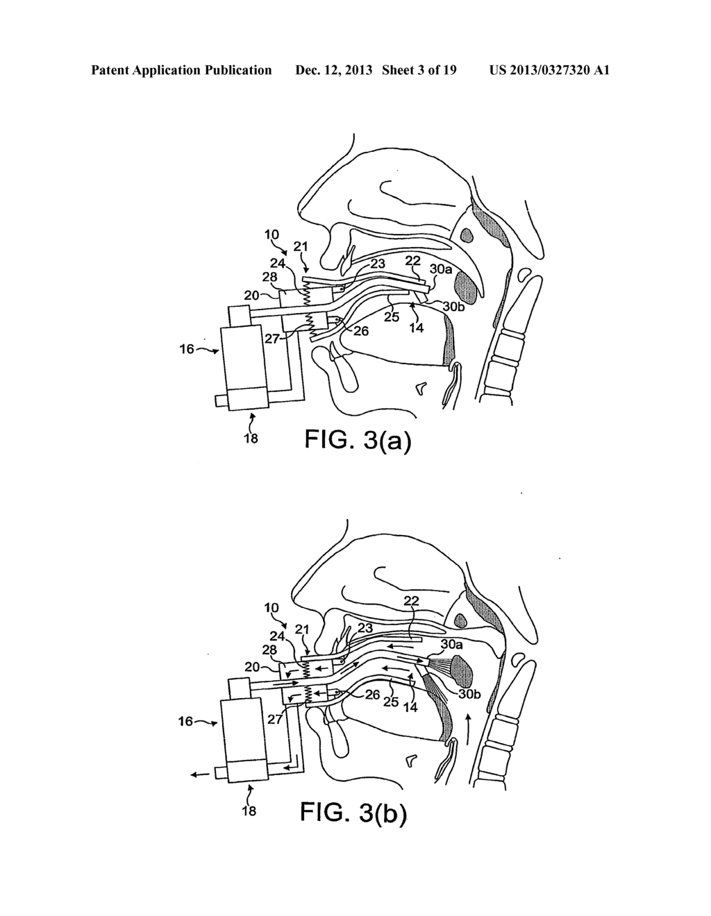 DELIVERY DEVICE AND METHOD - diagram, schematic, and image 04