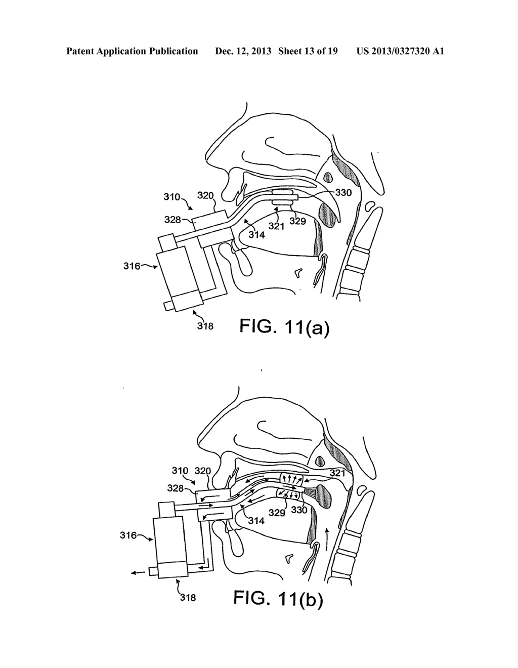 DELIVERY DEVICE AND METHOD - diagram, schematic, and image 14