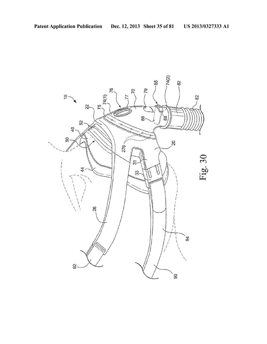 MASK SYSTEM - diagram, schematic, and image 36