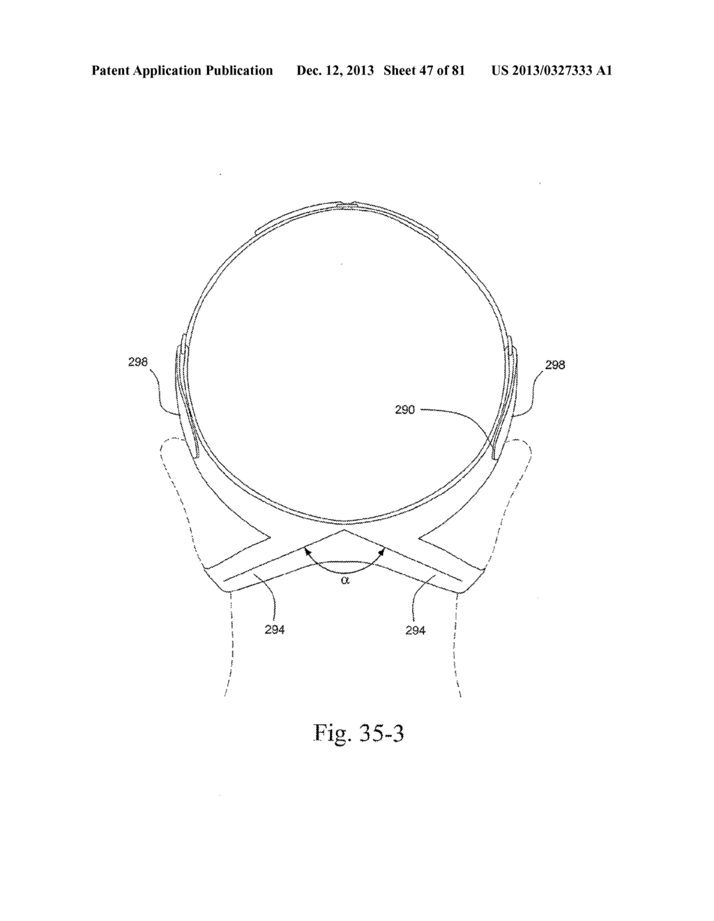 MASK SYSTEM - diagram, schematic, and image 48