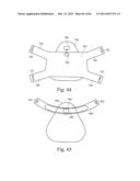 MASK SYSTEM diagram and image