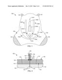 PERINEUM OVERLAY DEVICE diagram and image