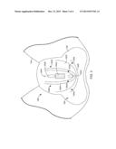 PERINEUM OVERLAY DEVICE diagram and image