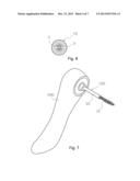 BRUSH FOR CLEANING INSIDE OF IMPLANT diagram and image