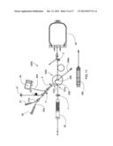 FILTER DEVICE diagram and image