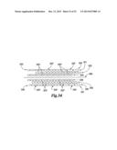 STAPLE CARTRIDGE COMPRISING A STAPLE DRIVER ARRANGEMENT diagram and image