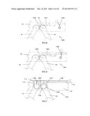 Support Mechanism diagram and image