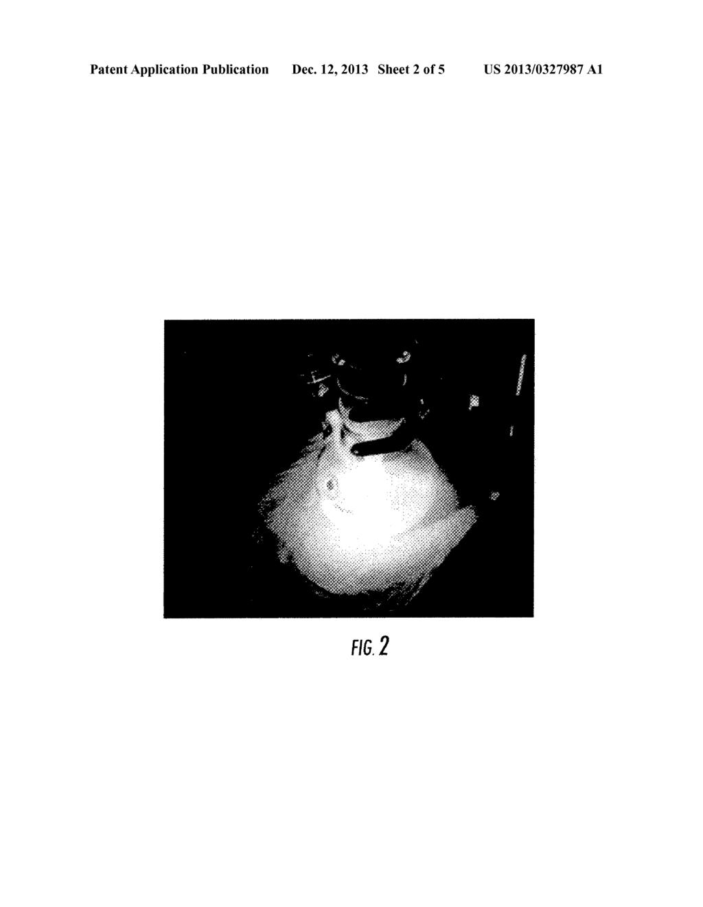 Production Of Fine Particles Of Functional Ceramic By Using Pulsed Laser - diagram, schematic, and image 03