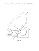 Method for Positioning a Metering Blade With Reference to Roller and Blade     Wear diagram and image