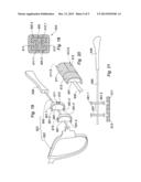 SIDEPIECE FOR EYEGLASSES, EYEGLASSES INCLUDING AT LEAST ONE SUCH     SIDEPIECE, AND METHOD FOR ASSEMBLING SUCH A SIDEPIECE diagram and image