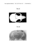 BRAIN TISSUE REGENERATION METHOD diagram and image