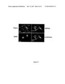 Method of Treating Degenerative Disorders of the Nervous System diagram and image