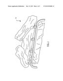 Blow-Molded Log Assembly for Electric Fireplaces diagram and image